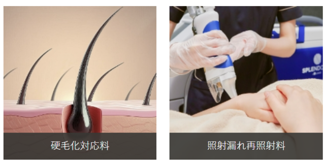 ウィルビークリニック‗硬化・打ち漏れ