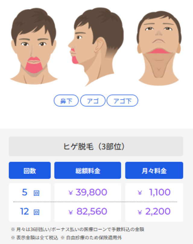 レジーナオム‗ヒゲ３部位