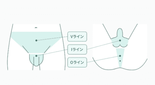 フレイアクリニックメンズ VIO脱毛