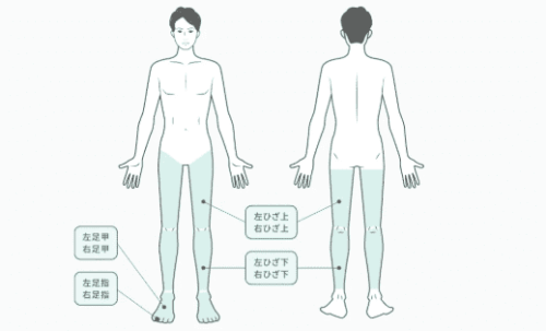 フレイアクリニックメンズ 脚全体脱毛