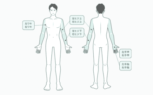 フレイアクリニックメンズ 腕全体脱毛