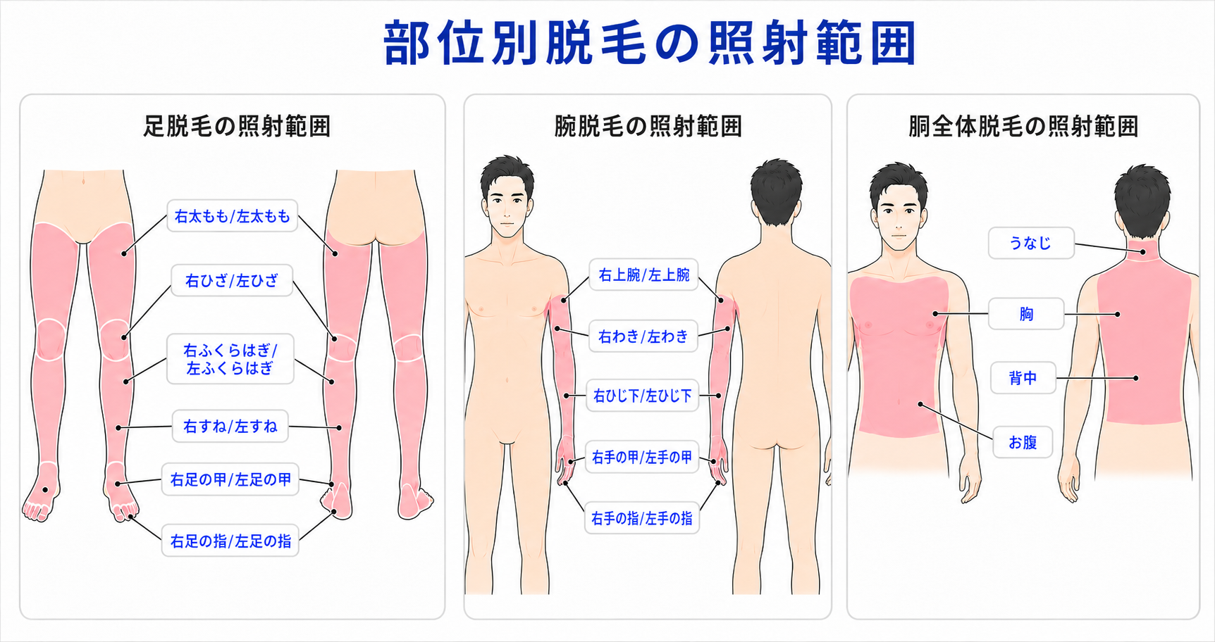 部位別脱毛　照射範囲