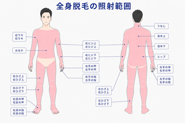 全身脱毛　照射範囲　フレイヤクリニックメンズ