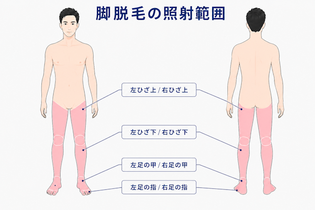 脚脱毛　照射範囲　フレイヤクリニックメンズ