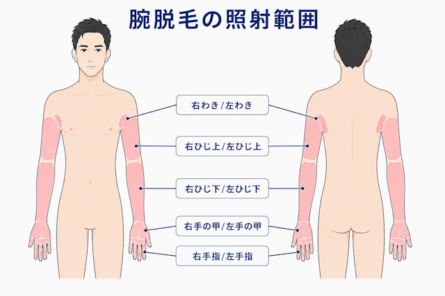 腕脱毛　照射範囲　フレイヤクリニックメンズ